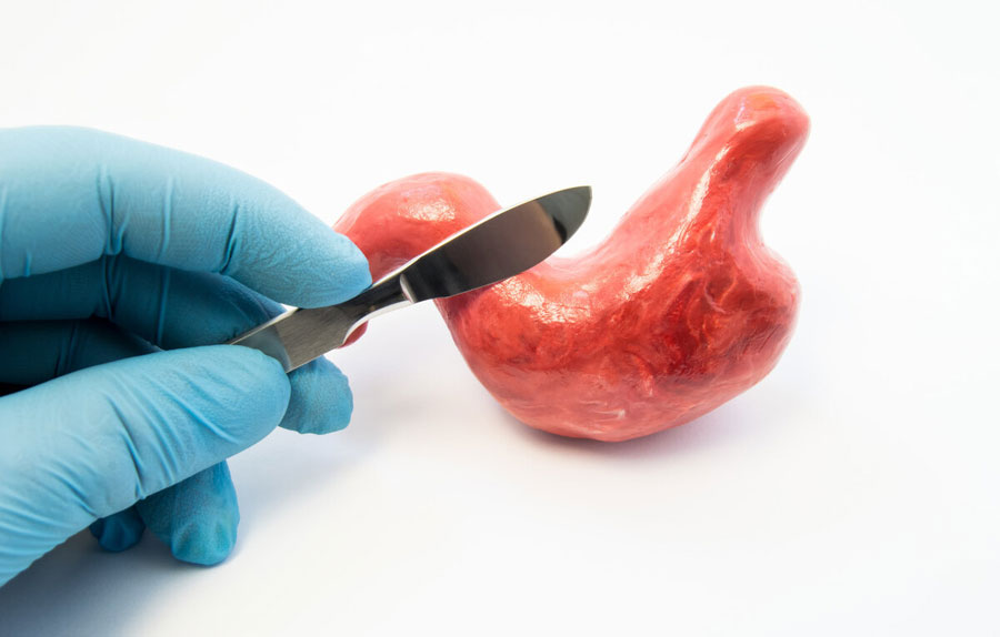 胃癌手术后护理怎么做？肿瘤专家：坚持做好这5件事，对术后康复有好处