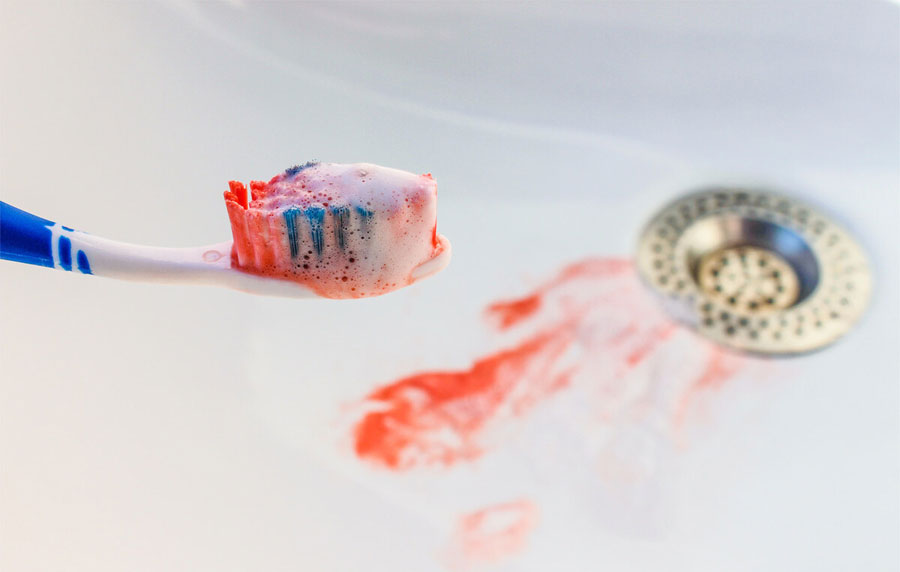 肝癌早期症状有哪些?肿瘤专家提醒:这7个症状要警惕,及时发现及时控制病情