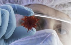 肺癌会出现哪些症状？肺癌的6大常见症状，国际肿瘤中心专家胡群峰教授一一为你解惑