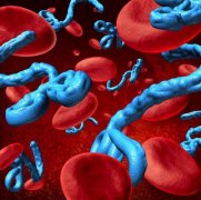 肝癌大多是“拖”出来的，身体出现“2黄1臭1痛”，肝可能要“报废”了 